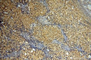 18157-1-AP - ZNF174