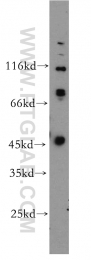 18157-1-AP - ZNF174