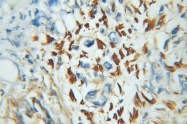 11374-1-AP - ZNF266