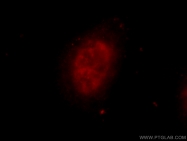 25147-1-AP - ZNF326