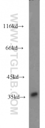 20794-1-AP - ZNF346