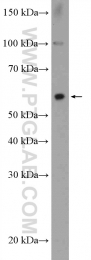 20799-1-AP - ZNF397