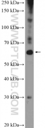 20799-1-AP - ZNF397