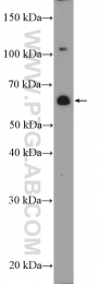 20799-1-AP - ZNF397