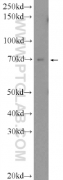 25299-1-AP - ZNF272