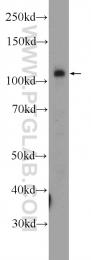 25242-1-AP - ZNF483