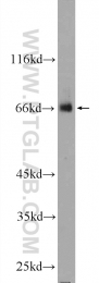 24508-1-AP - ZNF512