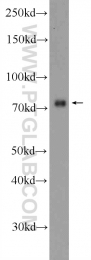 25592-1-AP - ZNF549
