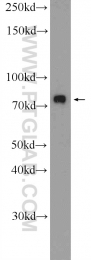 25592-1-AP - ZNF549