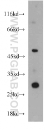 20922-1-AP - ZNF597