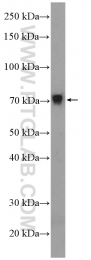 26128-1-AP - ZNF606