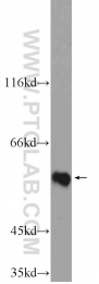 25797-1-AP - ZNF649