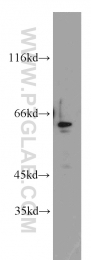 21329-1-AP - ZNF671