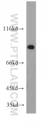 20539-1-AP - ZNF839