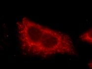20988-1-AP - TSC1 / Hamartin