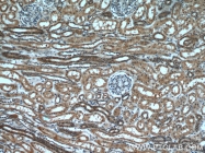 20988-1-AP - TSC1 / Hamartin