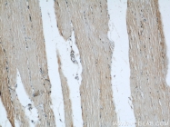 20988-1-AP - TSC1 / Hamartin