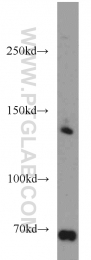 20988-1-AP - TSC1 / Hamartin