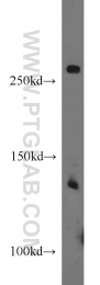 20988-1-AP - TSC1 / Hamartin