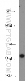 22670-1-AP - A4GNT