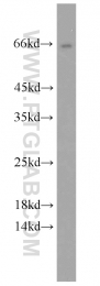 10928-1-AP - 11-beta HSD1 / HSD11B1