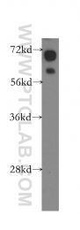 10928-1-AP - 11-beta HSD1 / HSD11B1