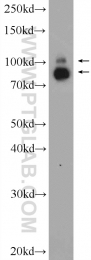 10736-1-AP - TER ATPase / VCP