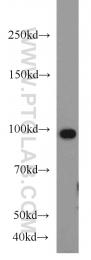 10736-1-AP - TER ATPase / VCP
