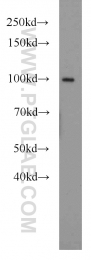 10736-1-AP - TER ATPase / VCP
