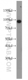 10736-1-AP - TER ATPase / VCP