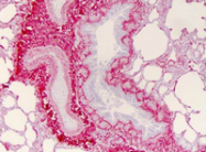 R1038 - Collagen type I
