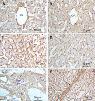 R1038 - Collagen type I