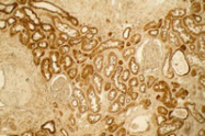 R1038 - Collagen type I