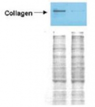 R1038B - Collagen type I