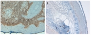R1038B - Collagen type I