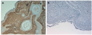 R1038B - Collagen type I