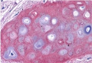 R1039 - Collagen type II alpha 1 chain