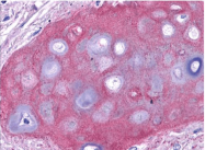 R1039B - Collagen type II alpha 1 chain