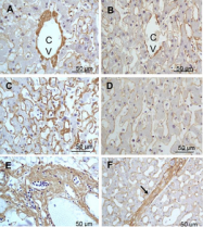 R1040 - Collagen type III alpha 1 chain