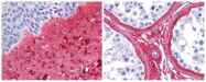 R1040B - Collagen type III alpha 1 chain
