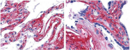 R1042 - Collagen type V