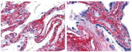 R1042B - Collagen type V