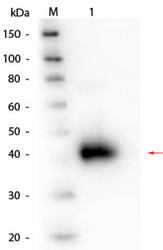 R1044PS - ORM1 / AGP1