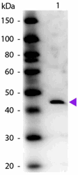R1046PS - Adenosine deaminase
