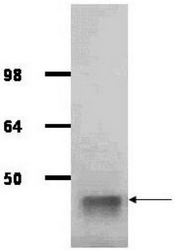 R1054PS - Aldolase A / ALDOA