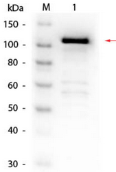 R1064BS - Beta-galactosidase tag
