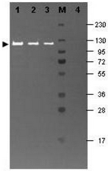 R1064FS - Beta-galactosidase tag