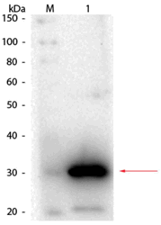 R1067PS - Carbonic anhydrase 1