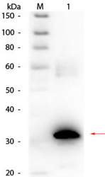 R1068BS - Carbonic anhydrase 2