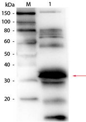 R1080BS - Folate receptor alpha